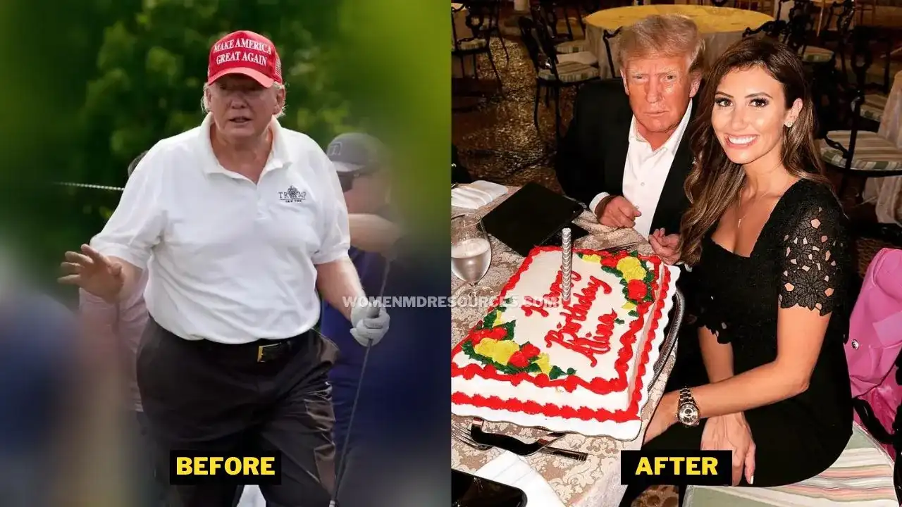 Donald Trump Weight Loss