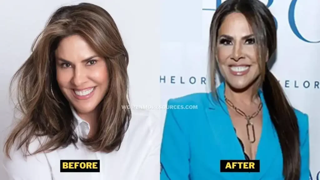 Jennifer Fessler Weight Loss, Plastic Surgery, Before After Pics, And Ozempic