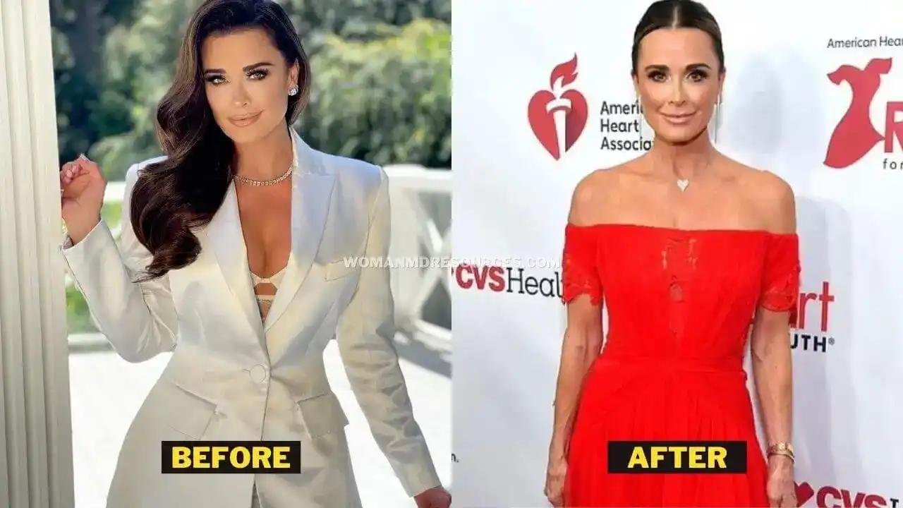Kyle Richards Weight Loss Comparison Picture