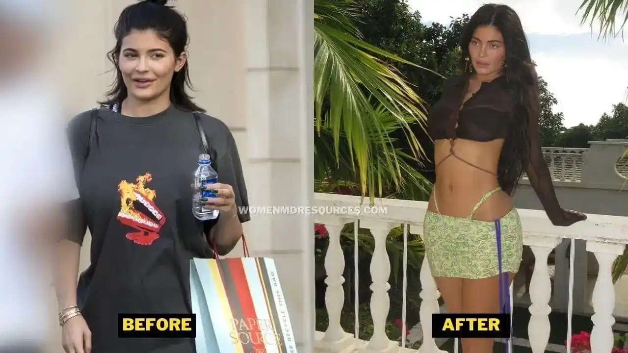 Kylie Jenner Weight Loss