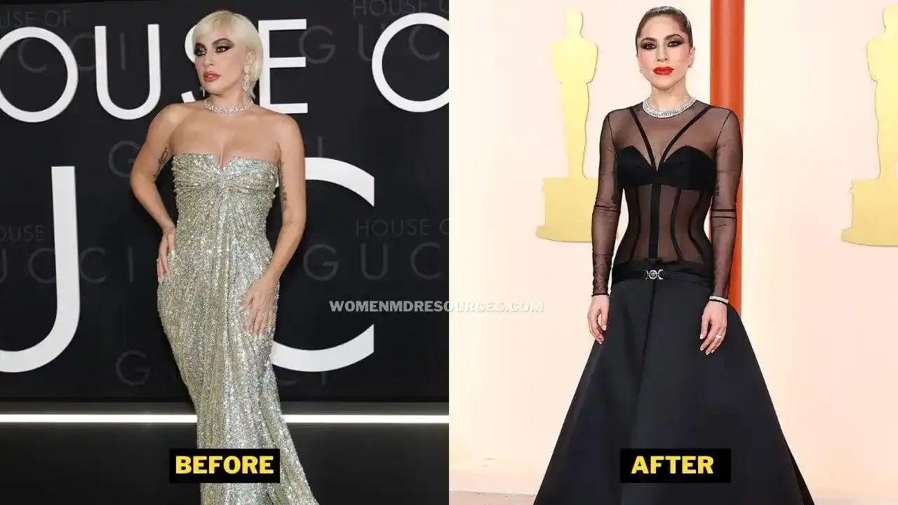 Lady Gaga Weight Loss