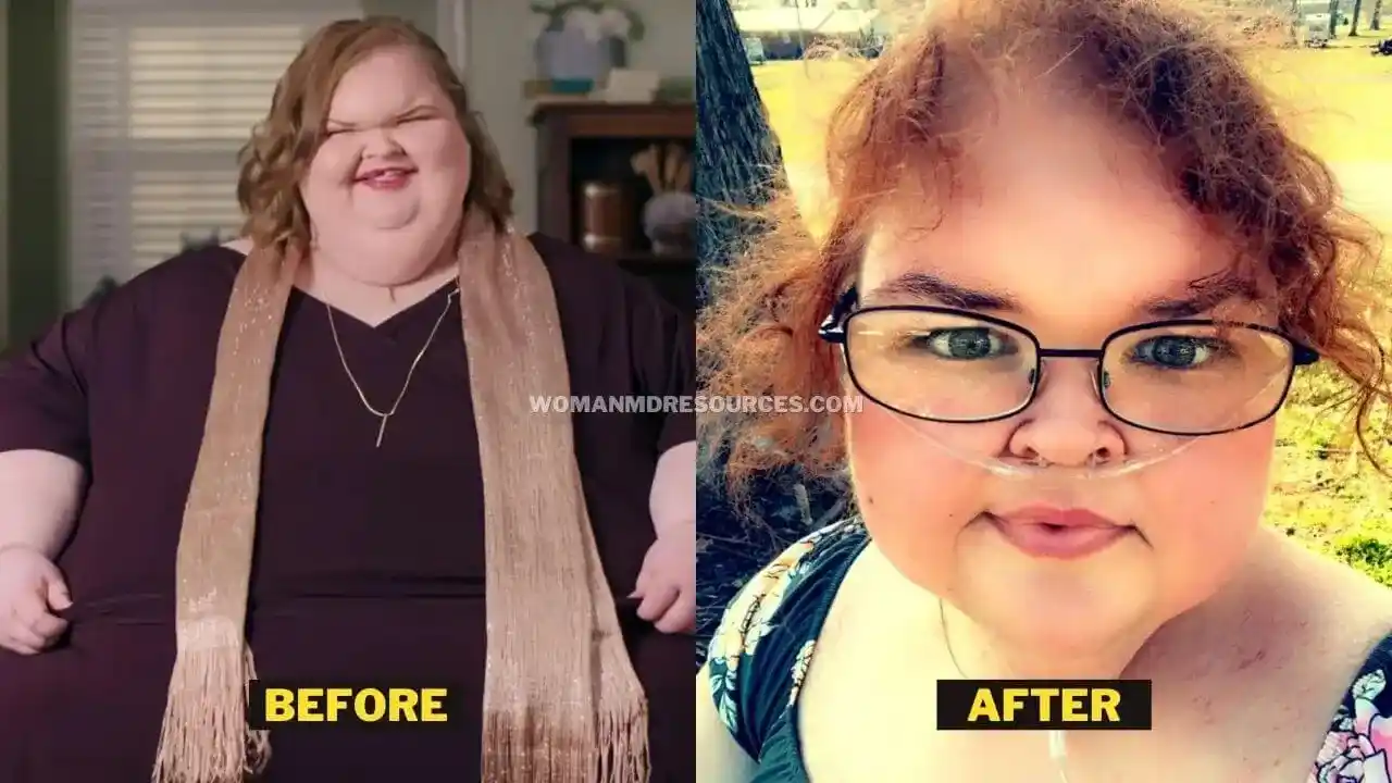 Tammy Slaton Before After Transformation