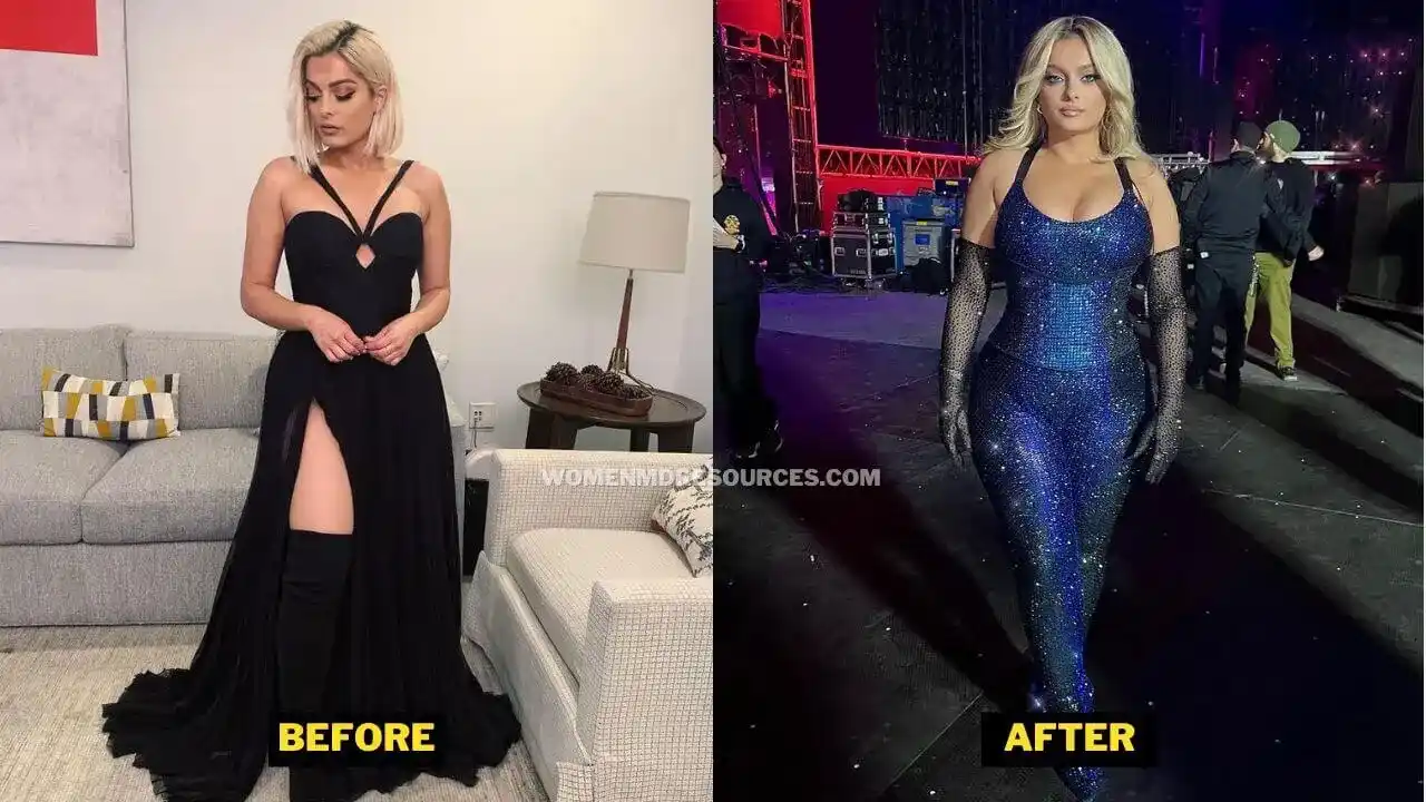 Bebe Rexha Before After