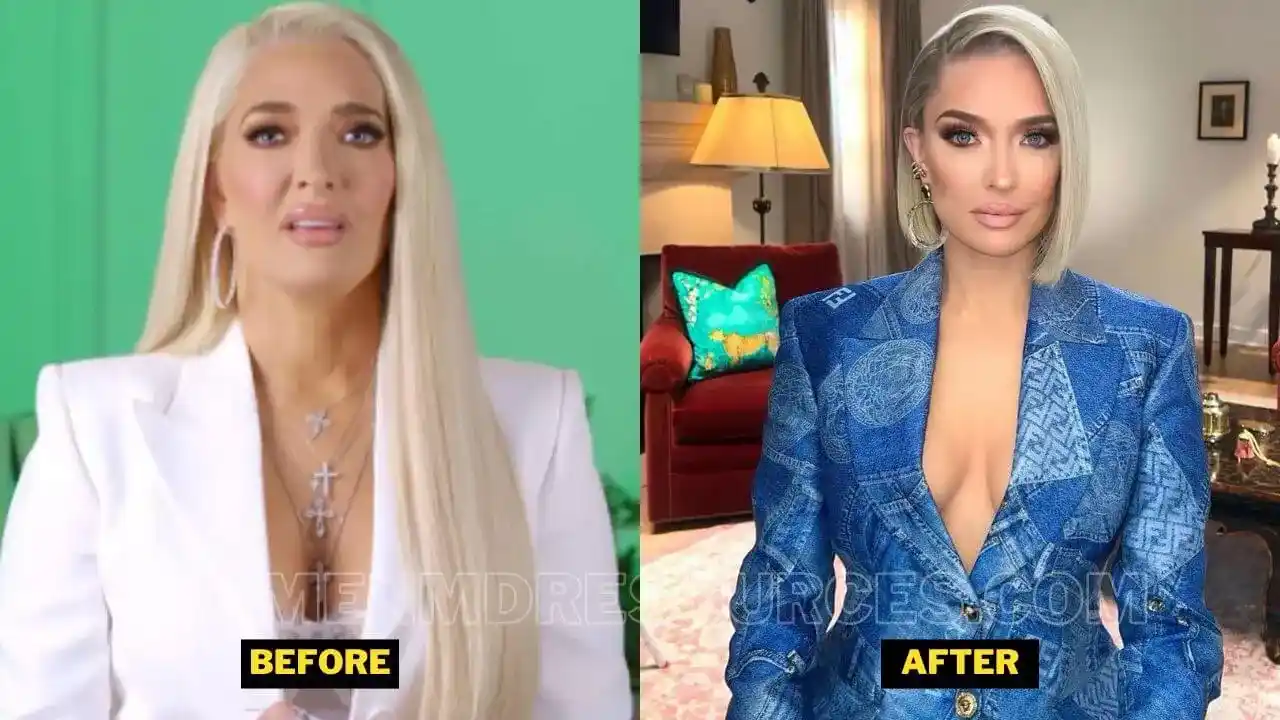 Erika Jayne Before After Picture