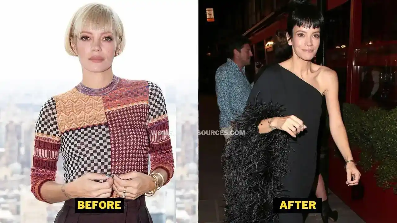 Lily Allen Weight Loss