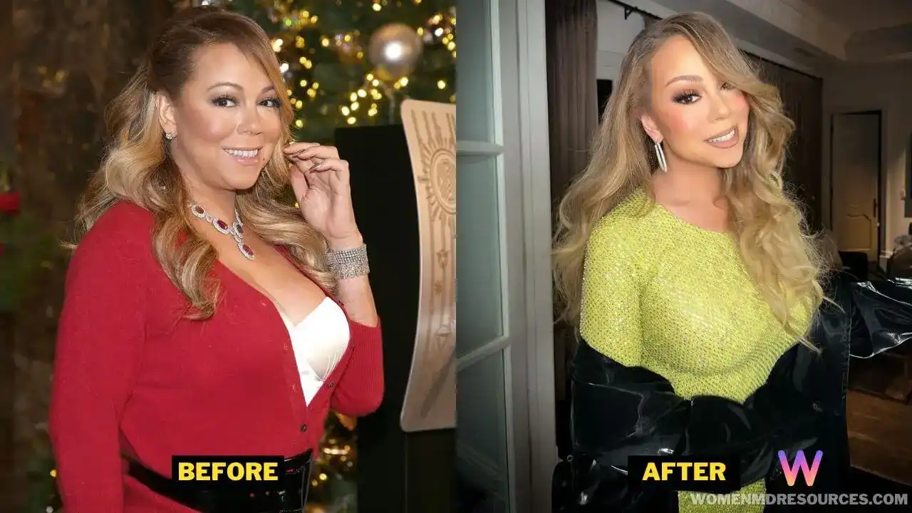 Mariah Carey Before After