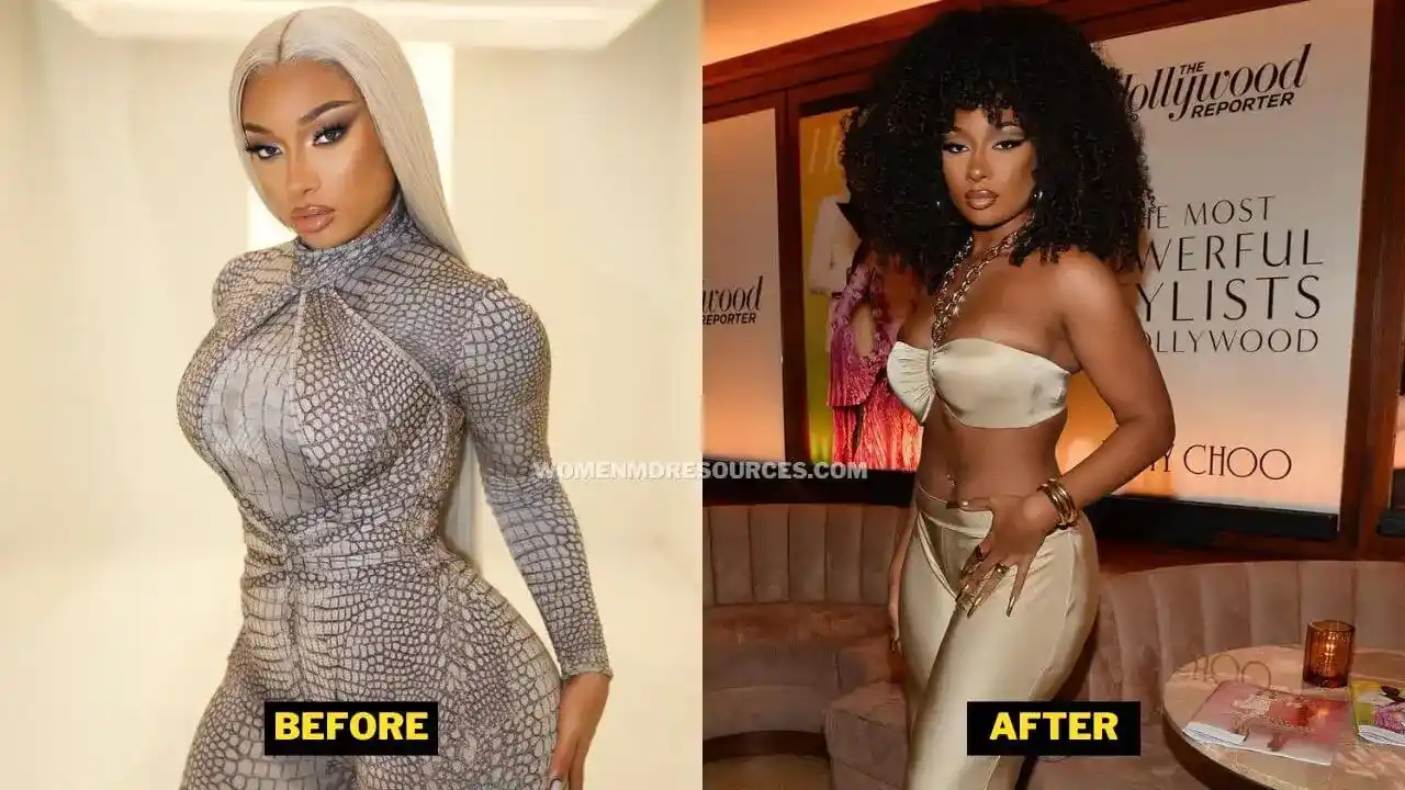 Megan Thee Stallion Before After