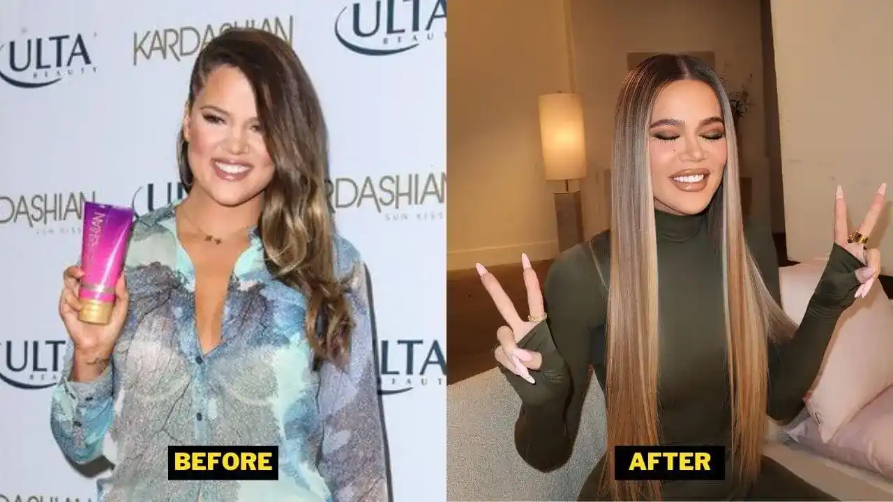 Khloe Kardashian Before After