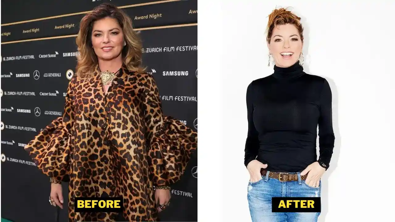 Shania Twain Before After