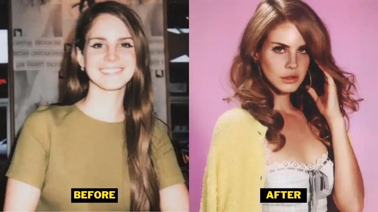 Lana Del Rey Nose And Lips Difference