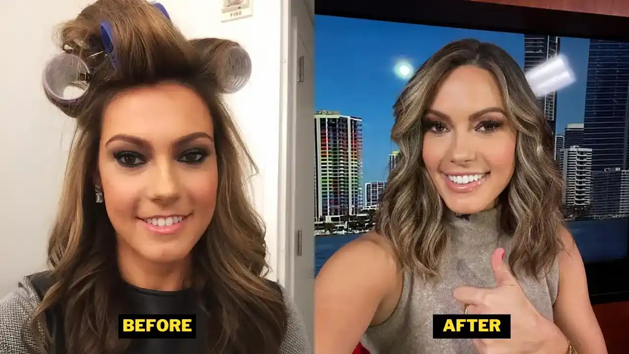 Lisa Boothe Teeth Before After