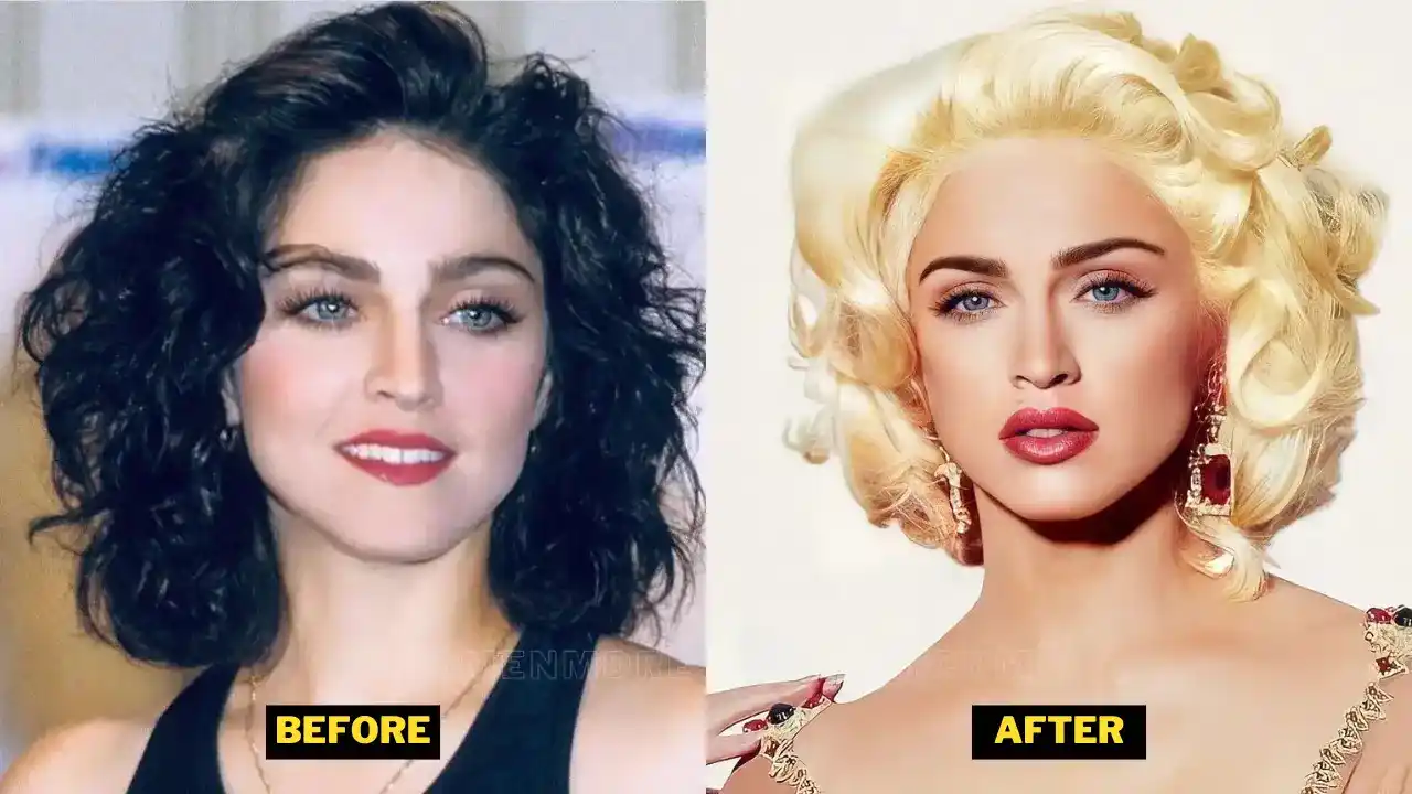 Madonna Before After