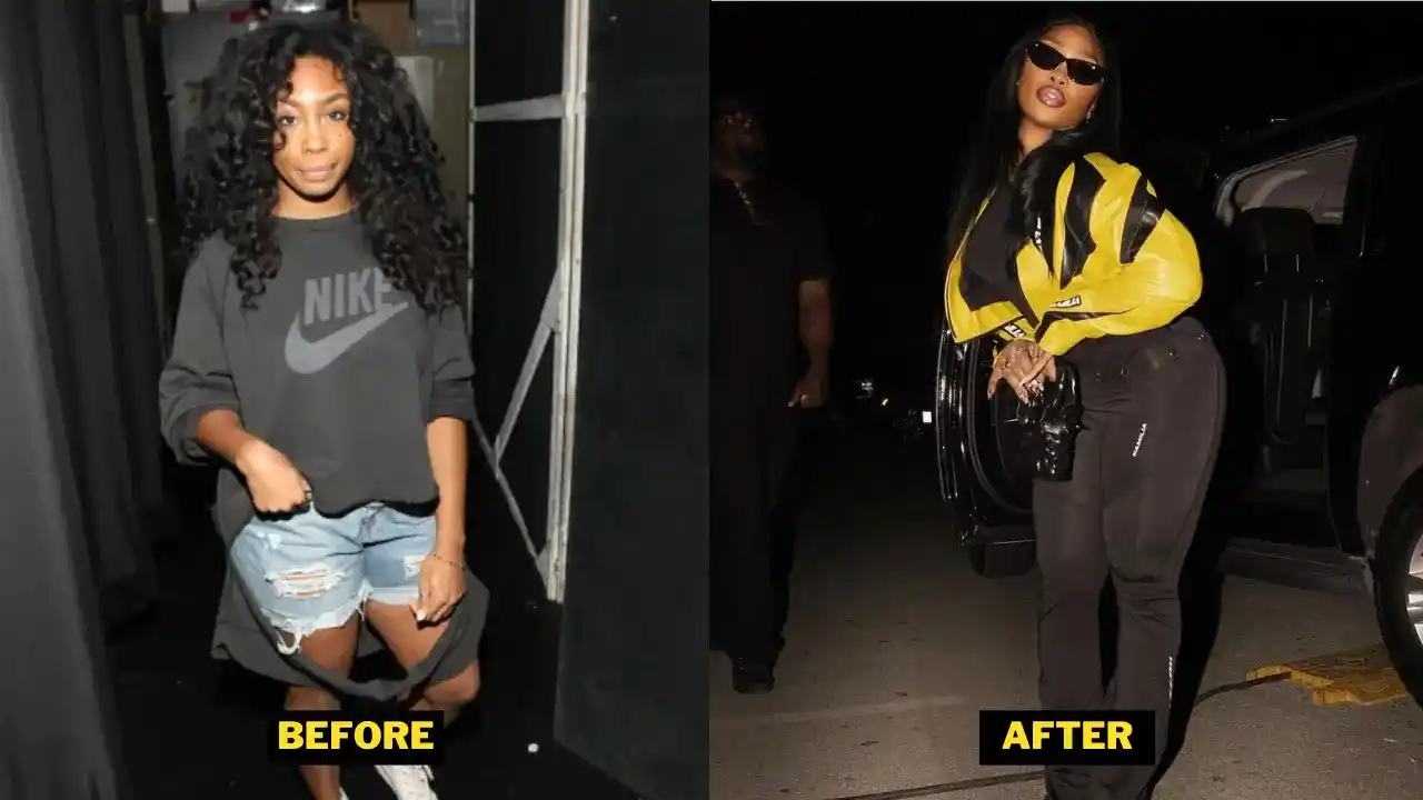 SZA Before After Surgery
