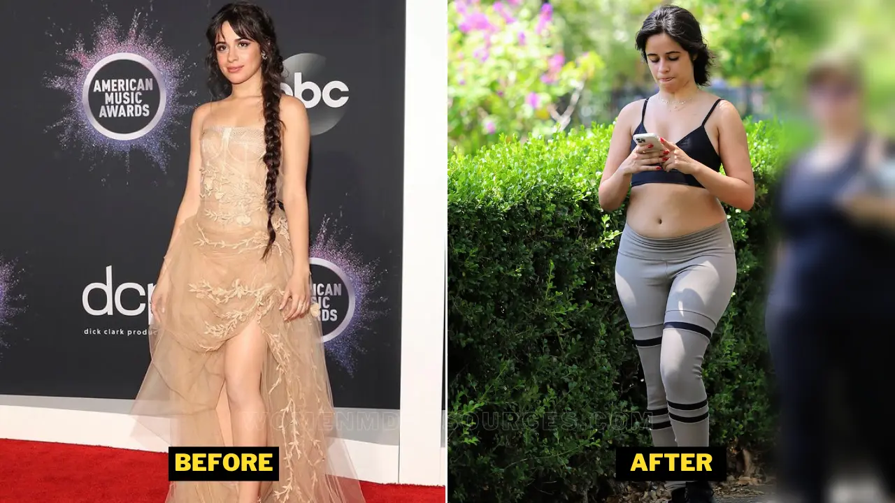 Camila Cabello Before After Picture