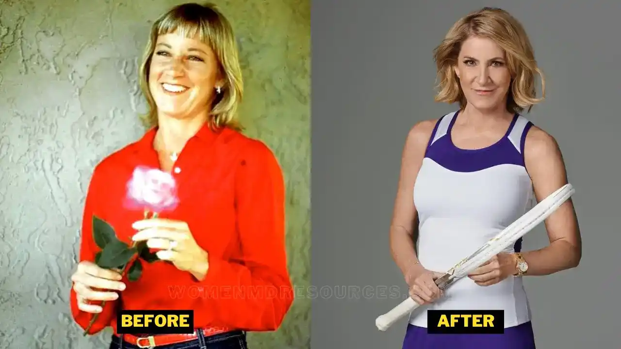 Chris Evert Transformation Picture