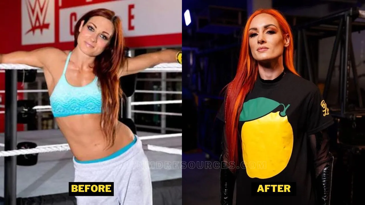 Becky Lynch Before After