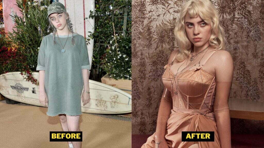 Billie Eilish Plastic Surgery. Her Boob Job Rumors