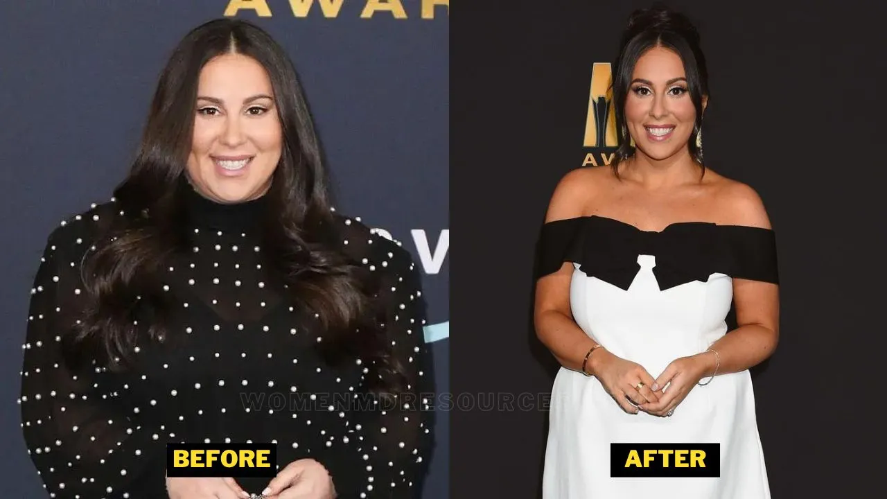 Claudia Oshry Before After