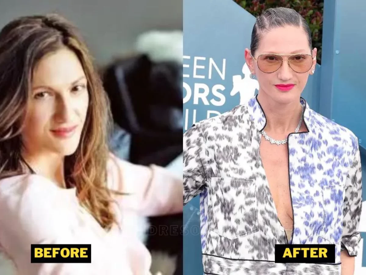 Unveiling the Truth: The Power of Plastic Surgery Reviews