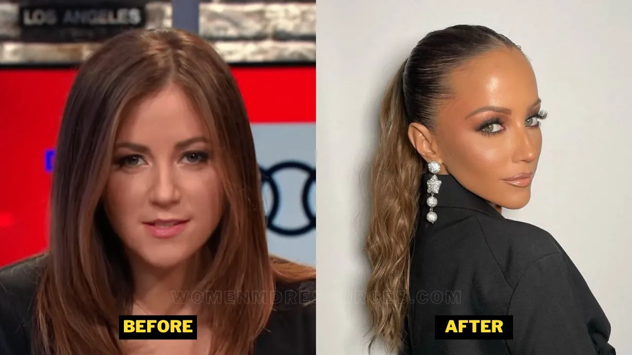 Kay Adams Before After Pictures