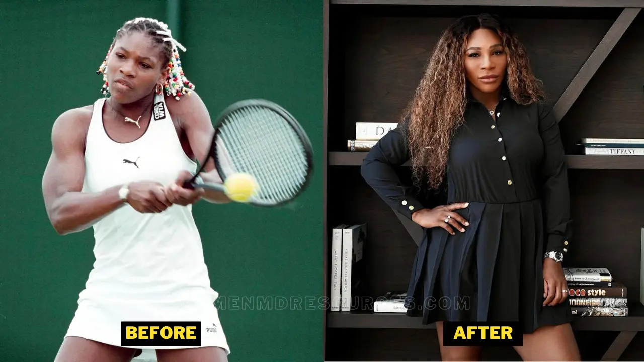 Serena Williams Plastic Surgery