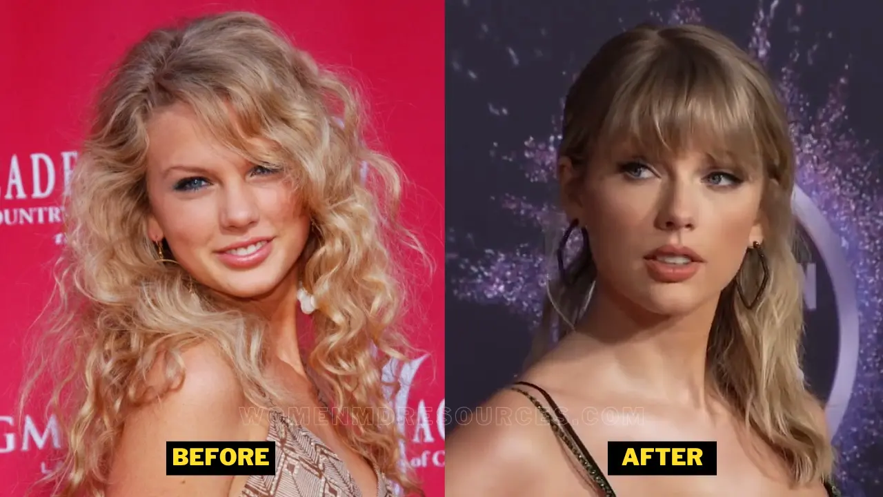Taylor Swift Plastic Surgery