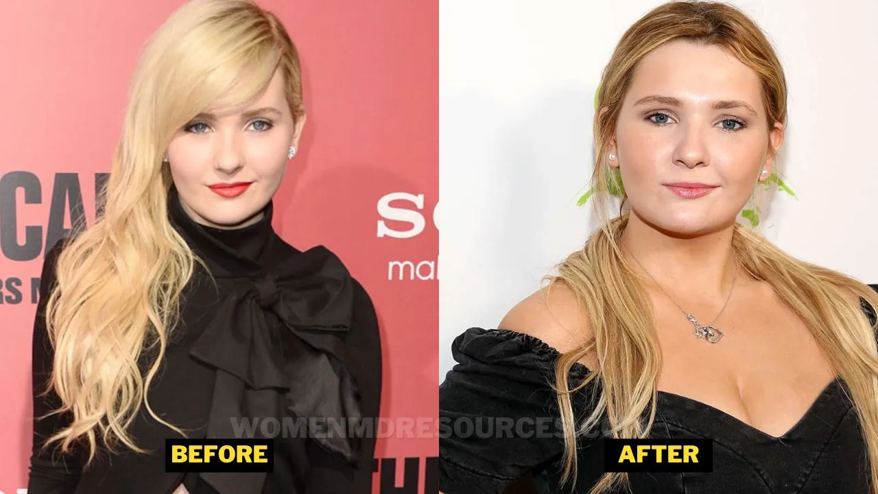 Abigail Breslin Gained Weight Over The Years
