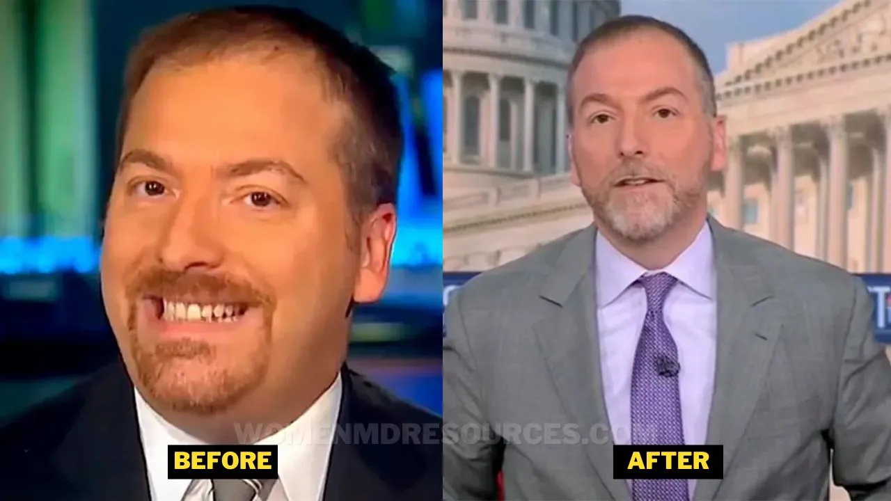 Chuck Todd Before After