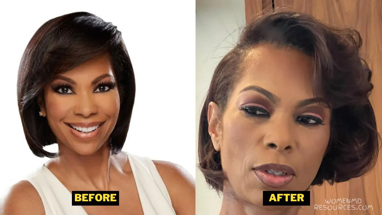 Harris Faulkner Transformation Over The Years